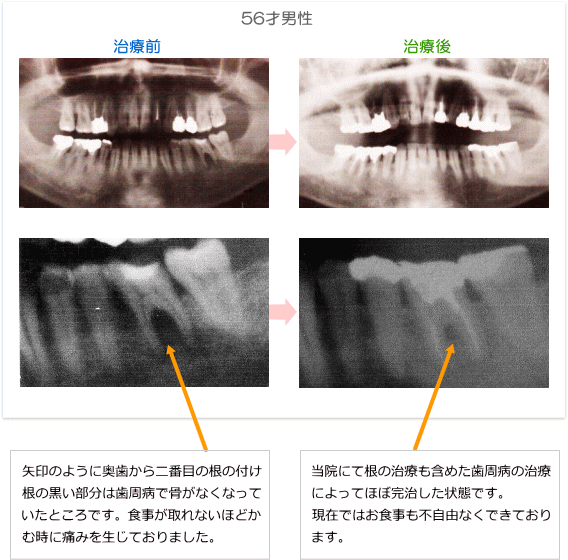 症例