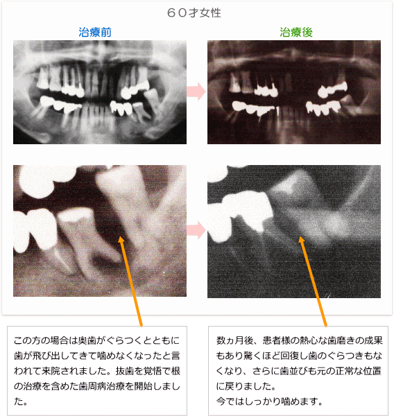 症例